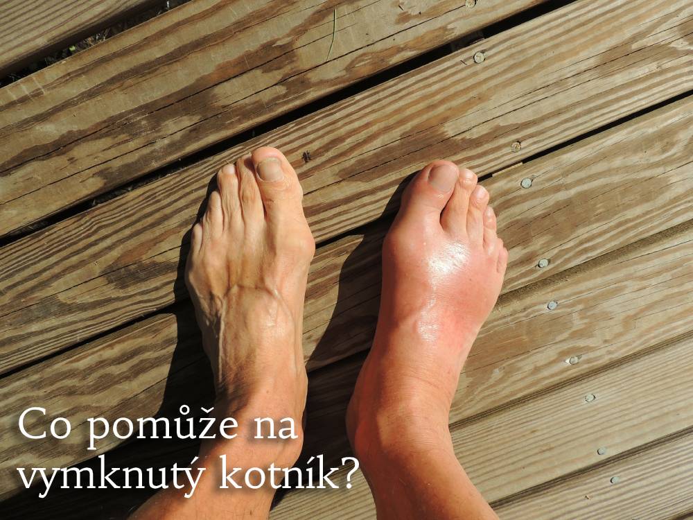 vymknutý kotník