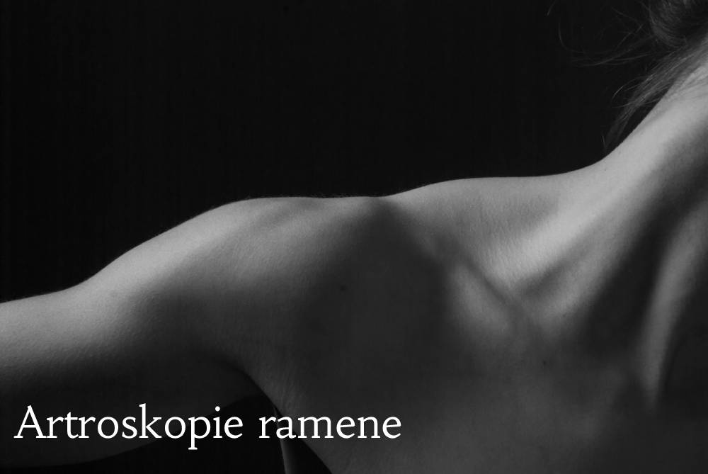 artroskopie ramene